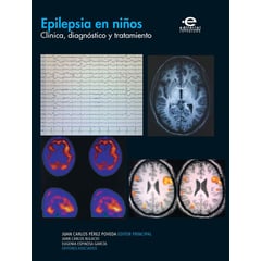 PONTIFICIA UNIVERSIDAD JAVERIANA - Libro Epilepsia En Niños Clinica Diagnostico Y Tratamiento